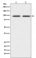 Anti-CD19 Rabbit Monoclonal Antibody